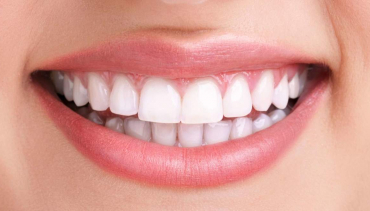 DSD aplicado en odontología