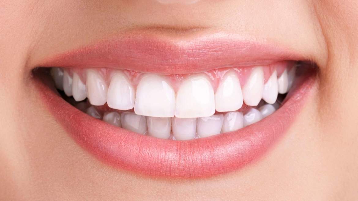 DSD aplicado en odontología