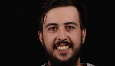 ¿Alguna vez te han dicho que padeces una enfermedad periodontal?