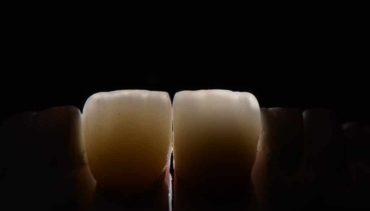 Ausencias dentales ¿Qué sucede cuando existen?