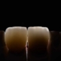 Ausencias dentales ¿Qué sucede cuando existen?