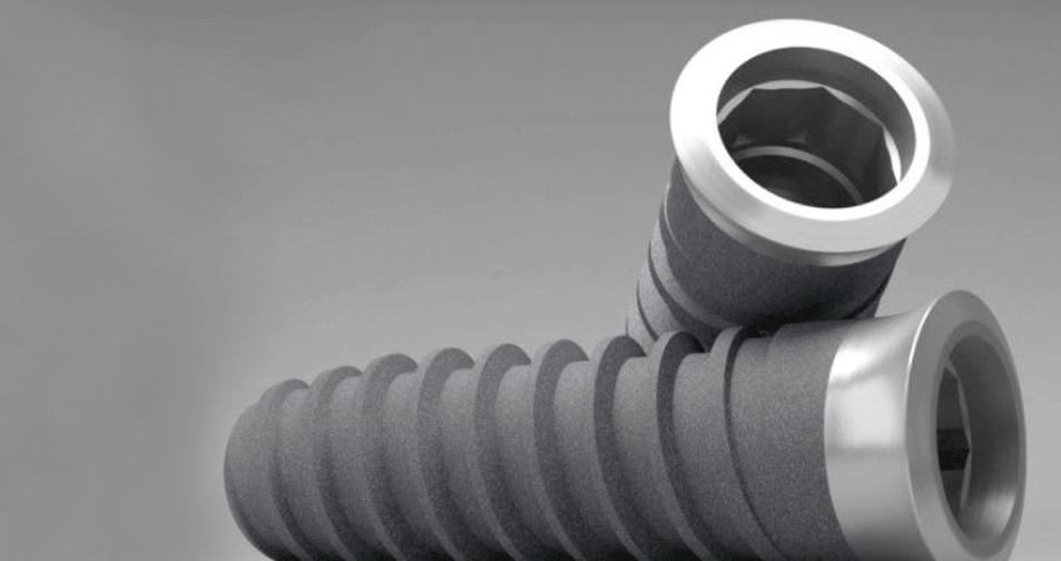 implantes dentales madrid