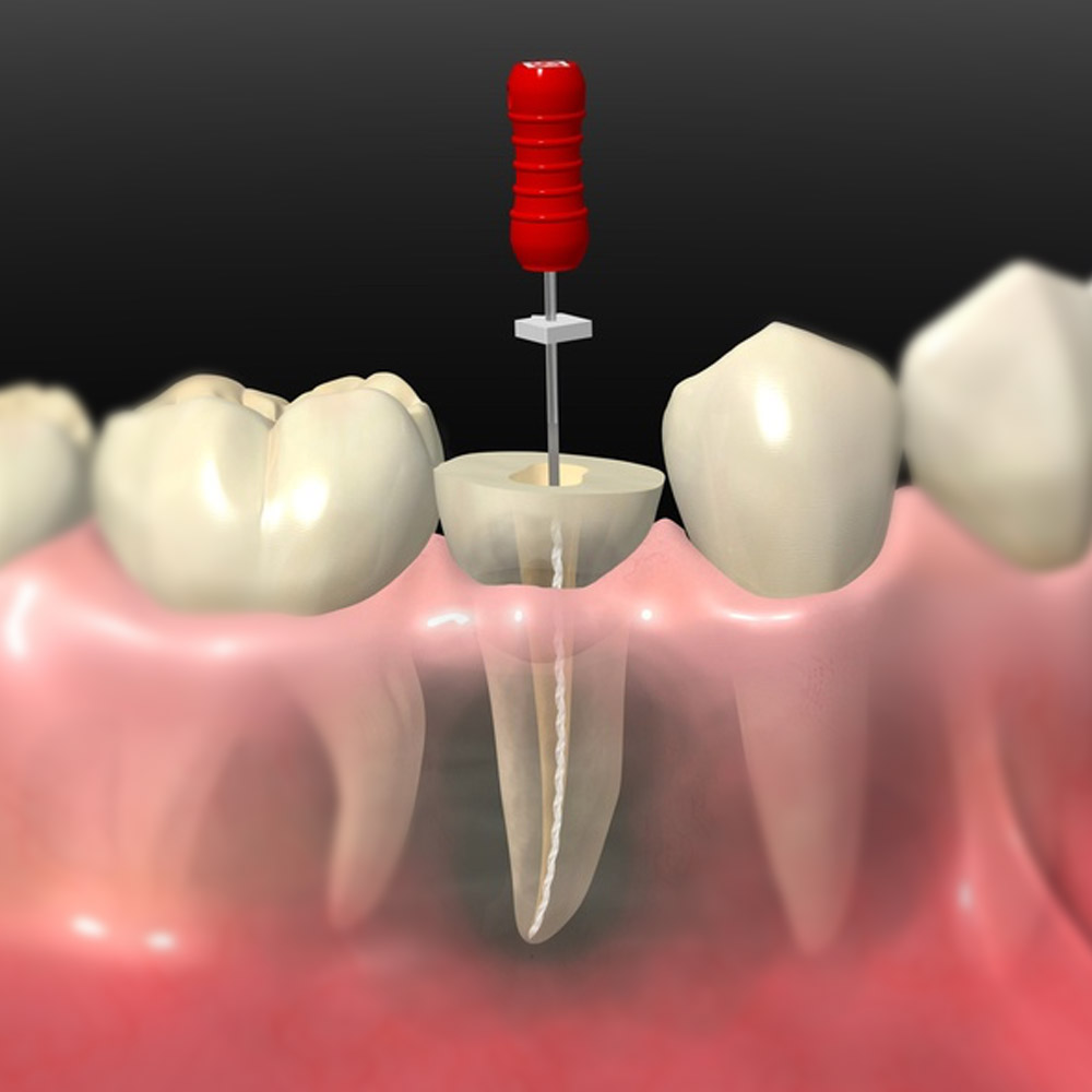 buena clinica dental