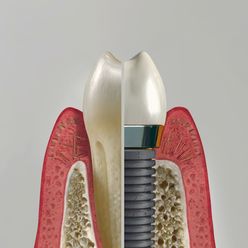 clinica dental madrid