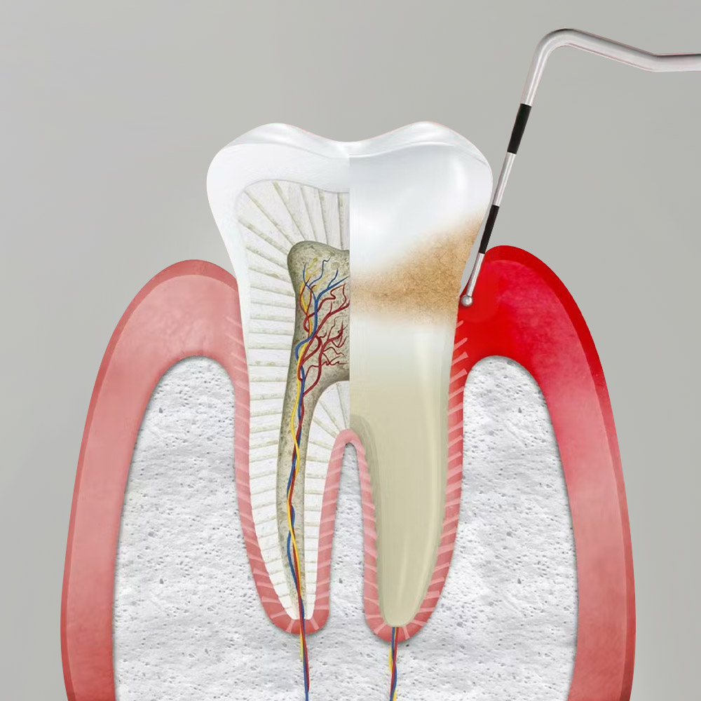 clinica dentista en madrid