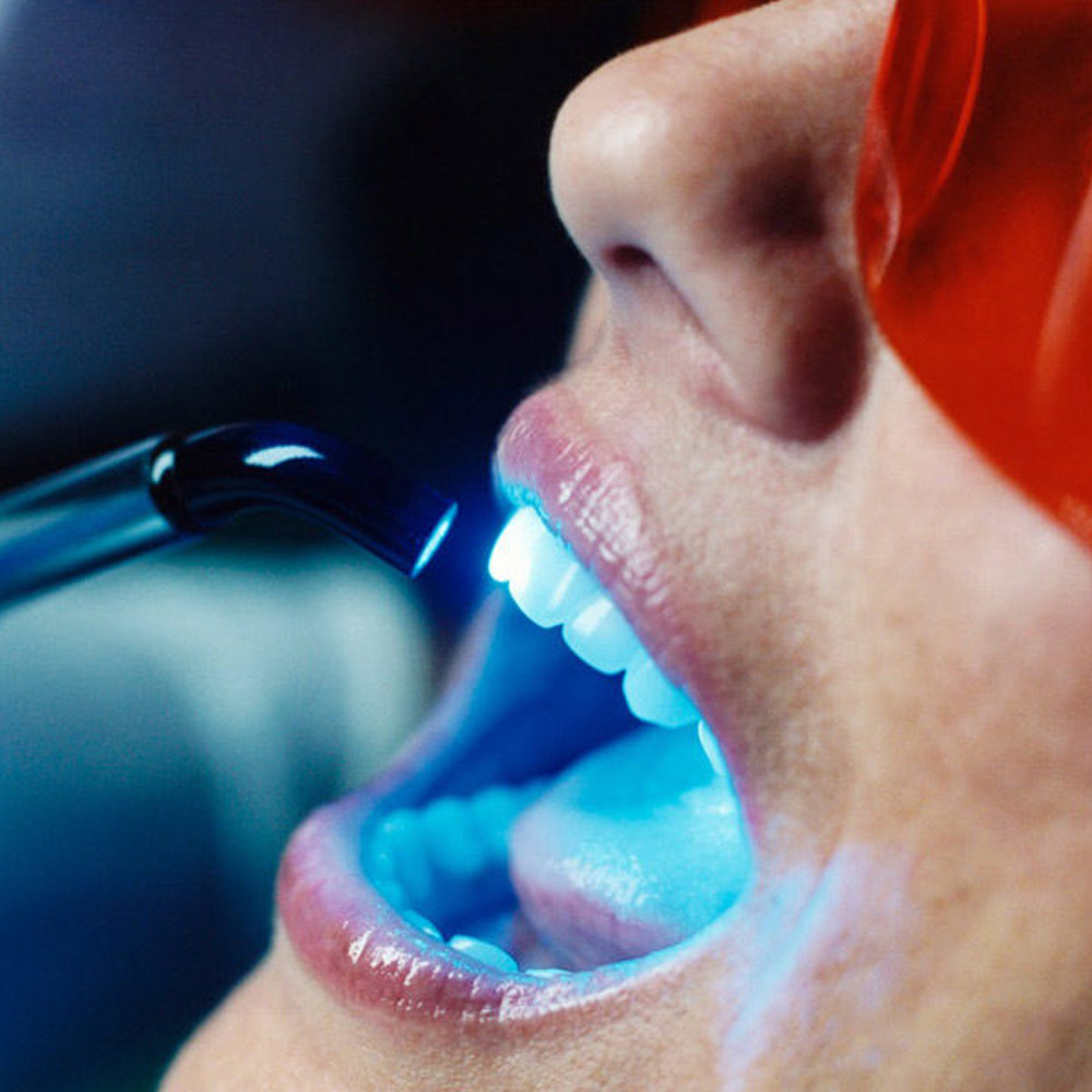 mejores clinicas dentales madrid