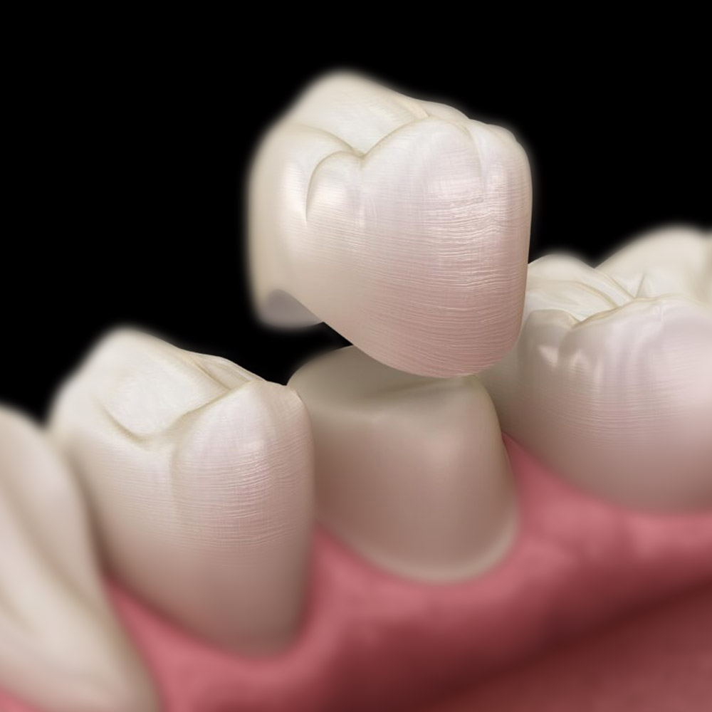 dentistas quevedo madrid