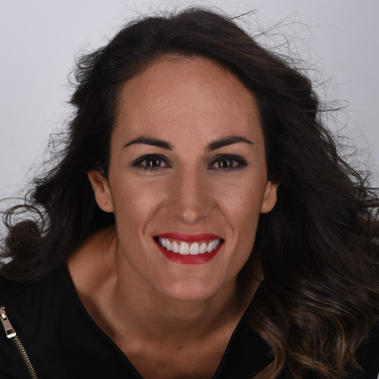 Antes y después de diseño de sonrisa natural con carillas dentales en Madrid - Caso real Q-Dental.