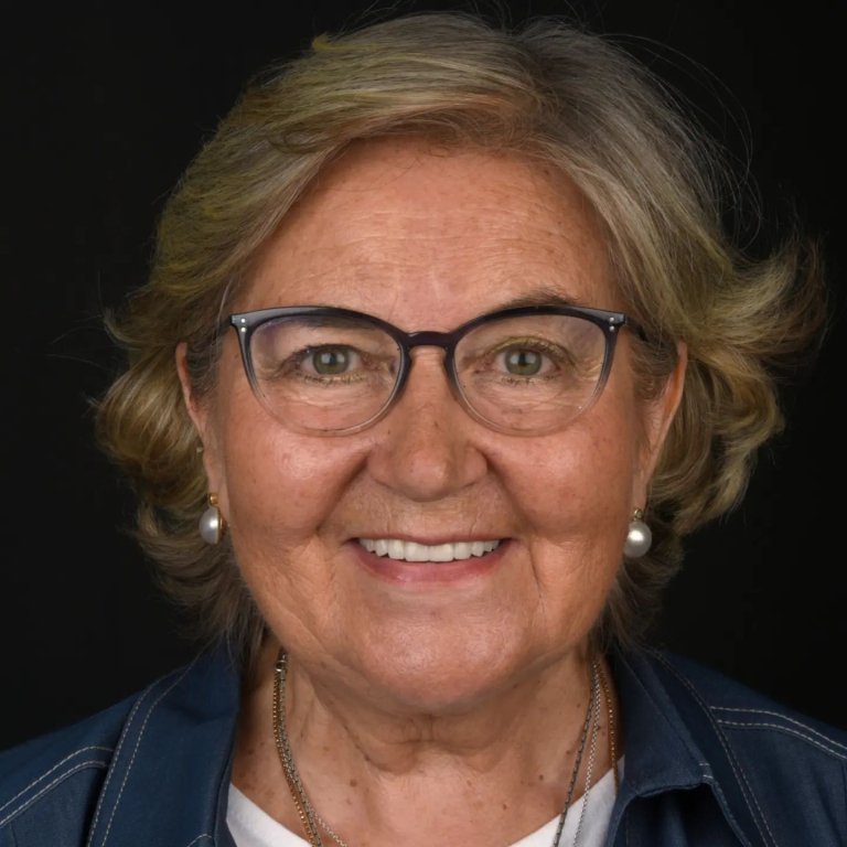 Antes y después de implantes dentales: recuperación de sonrisa y funcionalidad en Q-Dental Madrid.