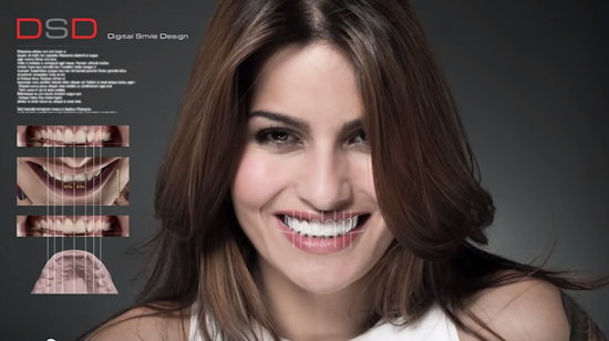 Clinica-estetica-dental-Madrid Clinica-estetica-dental-Madrid