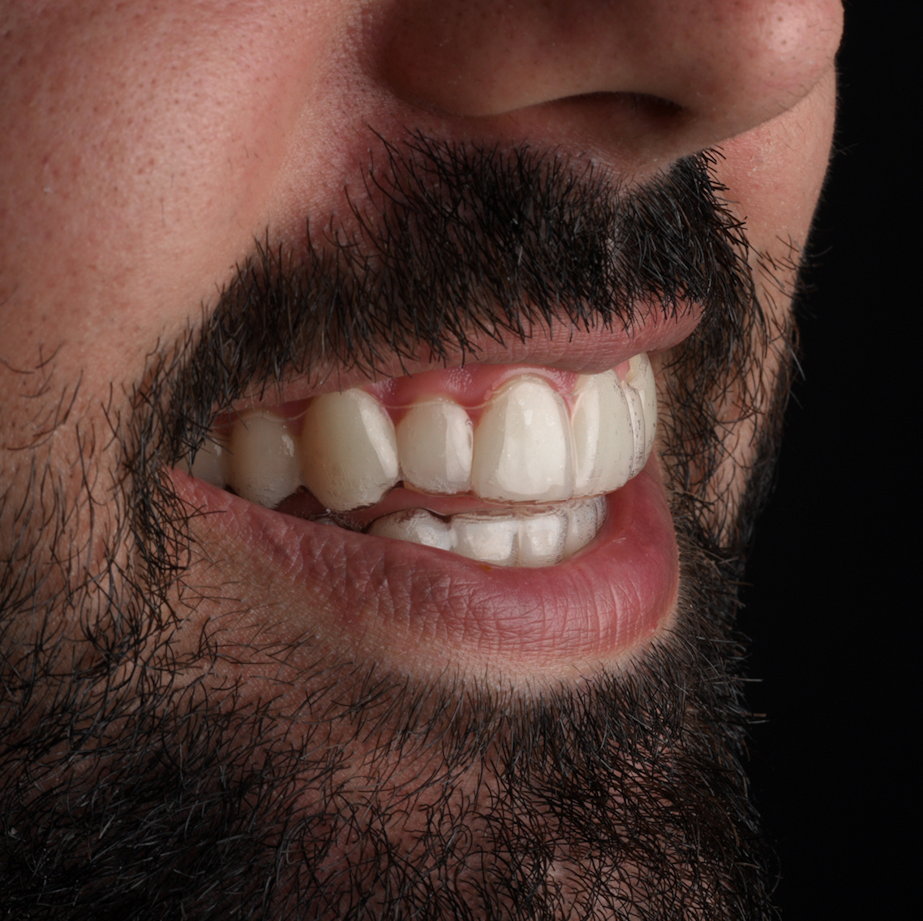 clinicas_dentales_en_madrid